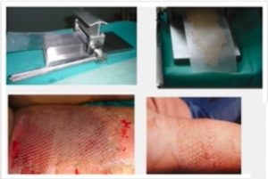 Formación Internacional de Rehabilitación en Cirugía Plástica med academy