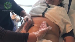 Curso de Rehabilitación Dermatofuncional y Estética MED ACADEMY