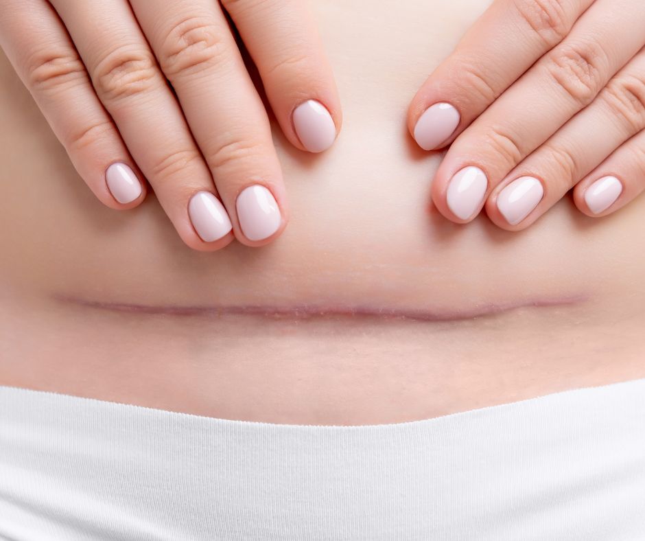 Curso Manejo de Cicatrices Med Academy