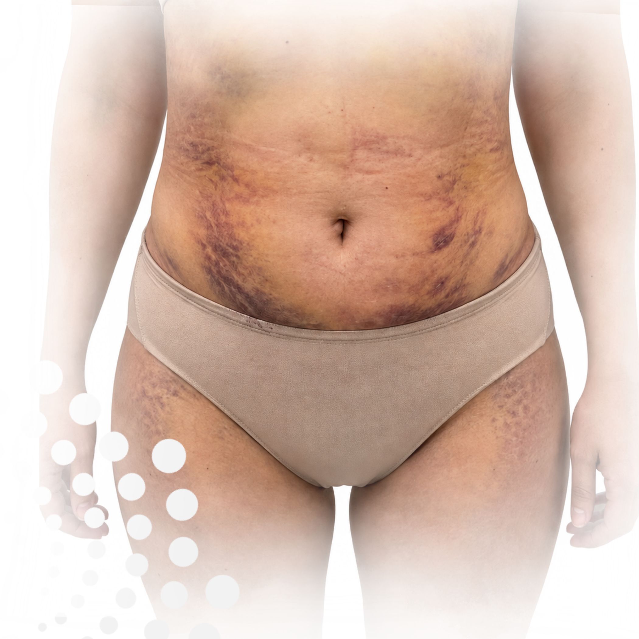 Curso-kinesiologia-fisioterapia- cirugia-plastica