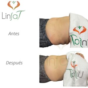 Drenaje Linfático Metodo Linfat