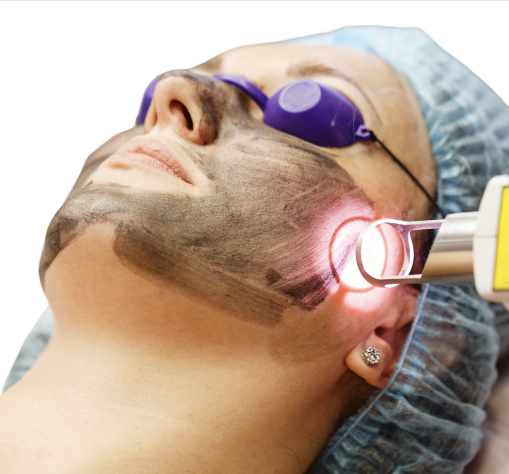 curso luz y laser para rejuvenecimiento facial
