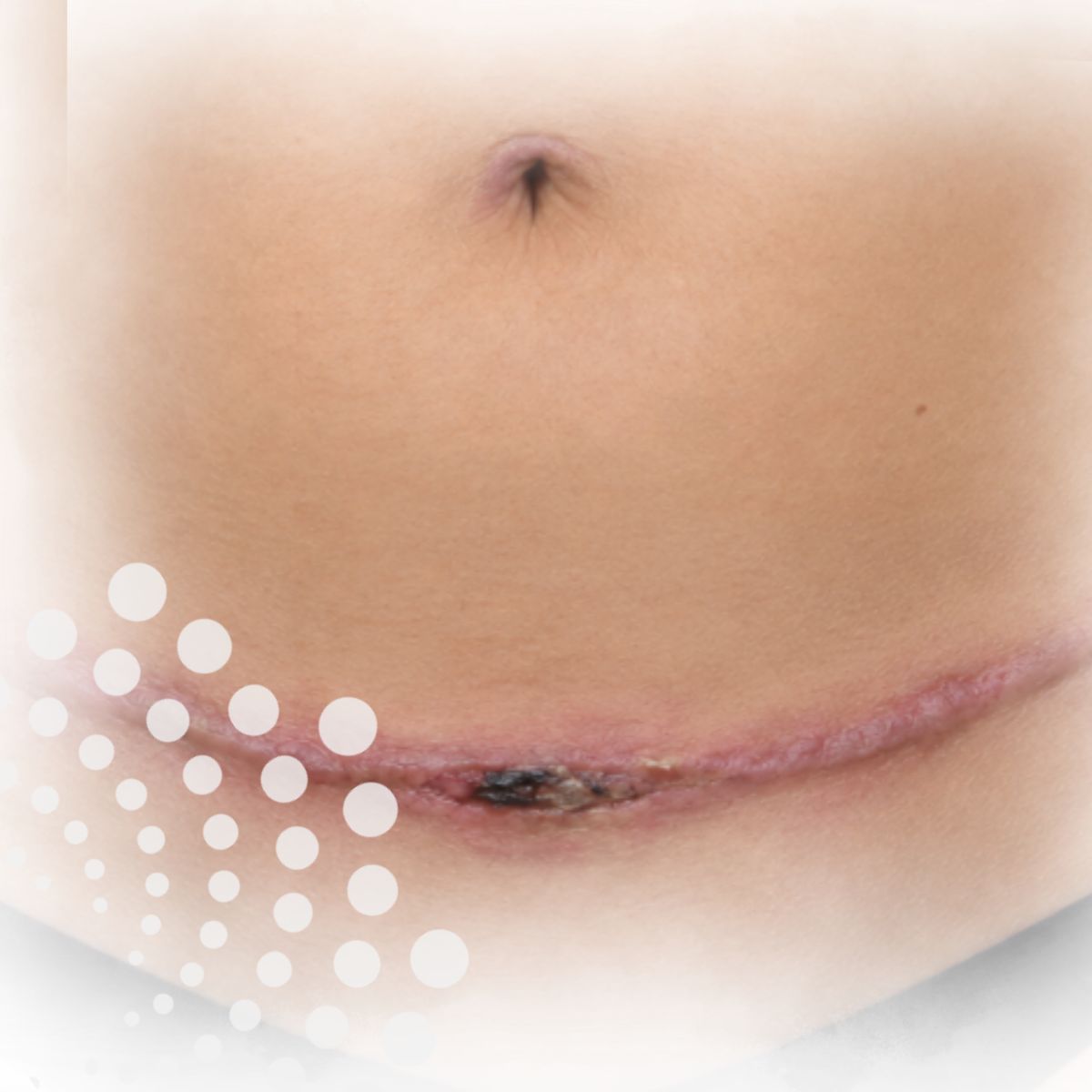 Curso-kinesiologia-cirugía-plástica