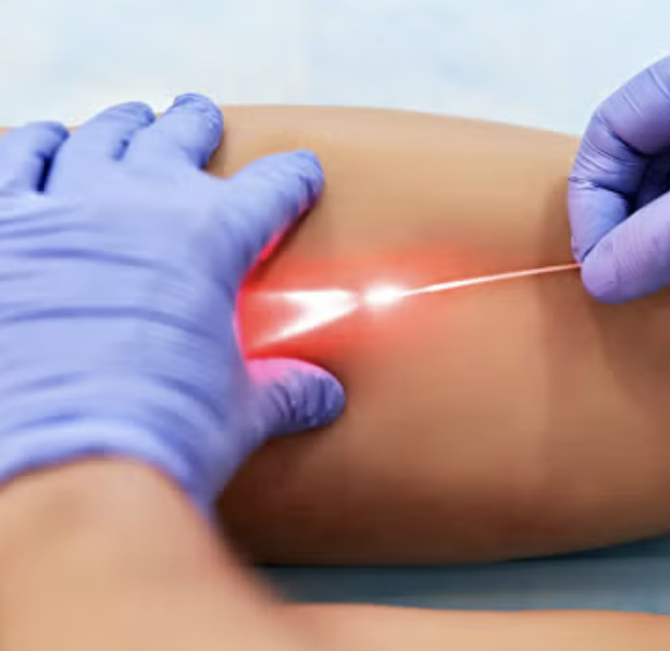 pre y post quirurgico con endorser