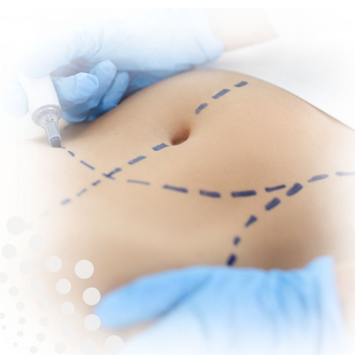 Curso heridas y necrosis en cirugia plastica